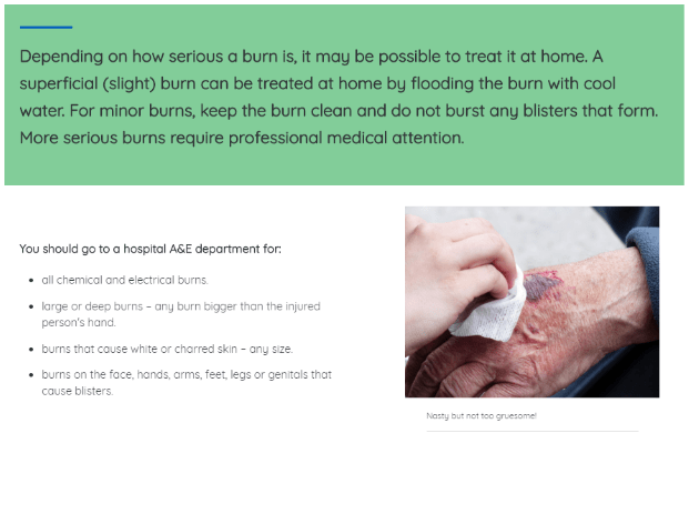 fire safety burns fire safety burns
