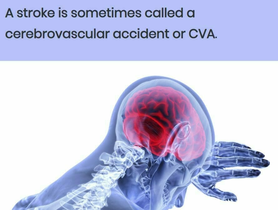 Stroke screenshot 4 Stroke course image 4