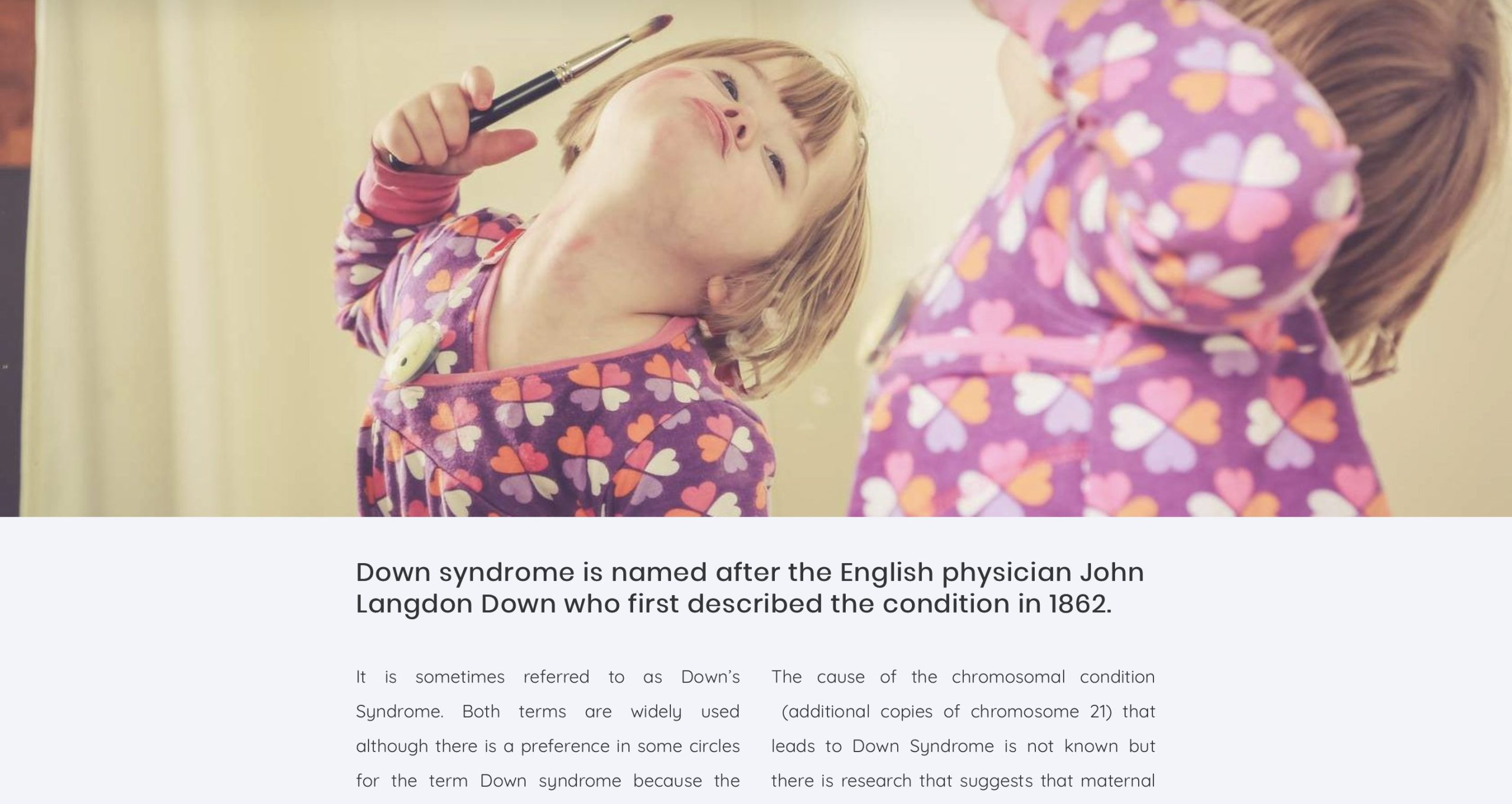 Down-syndrome-1 Down-syndrome-1