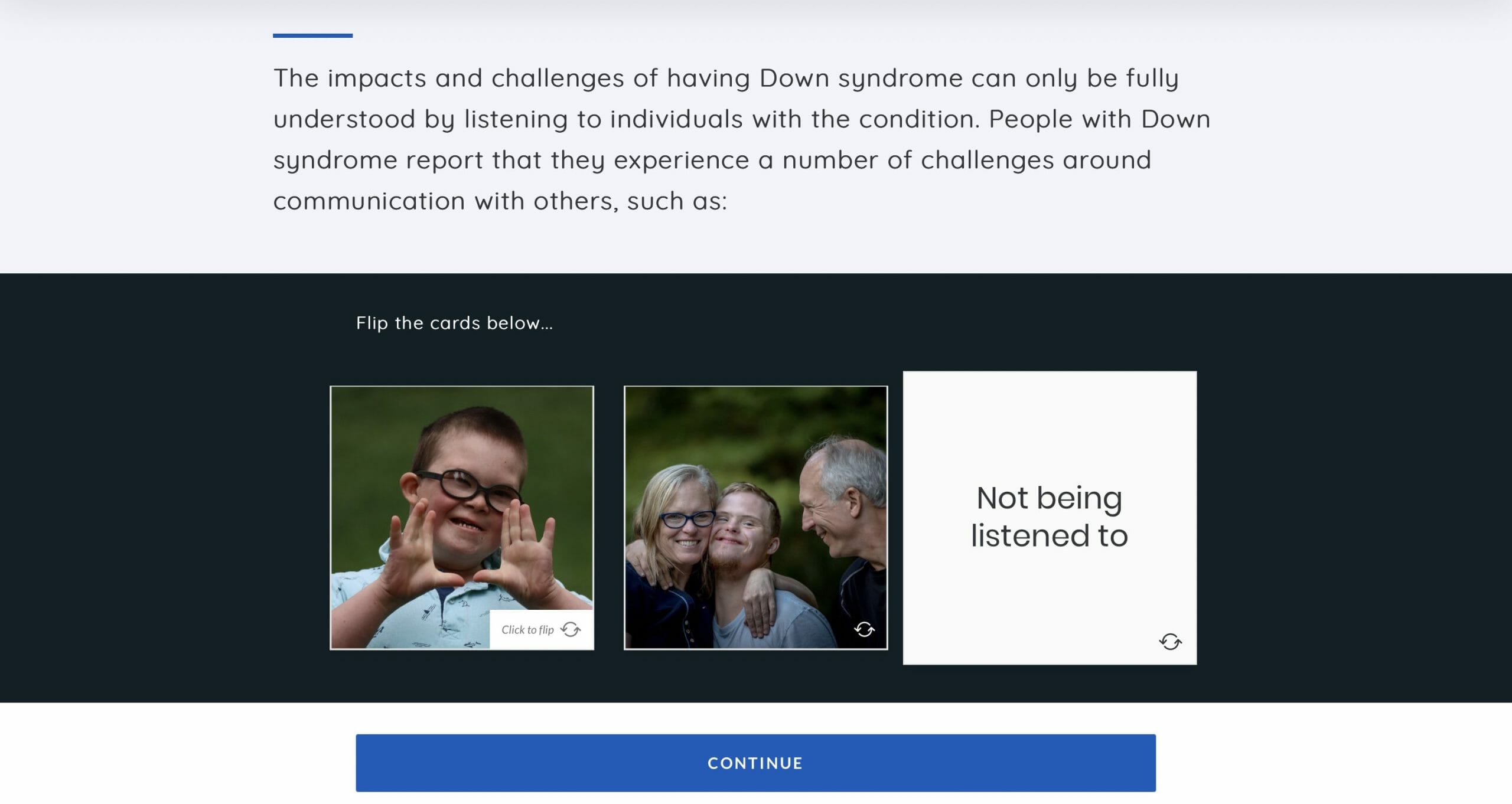Down-syndrome-2 Down-syndrome-2