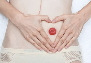 stoma care main image stoma care main image